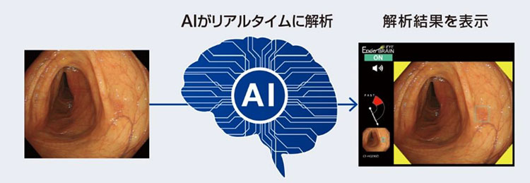 EndoBRAINイメージ画像